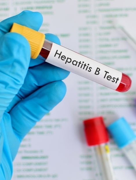 Hepatitis B Test - STD & STI Testing Online - Stigma Health