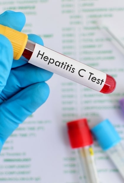 Hepatitis C test - STD & STI Testing Online - Stigma Health