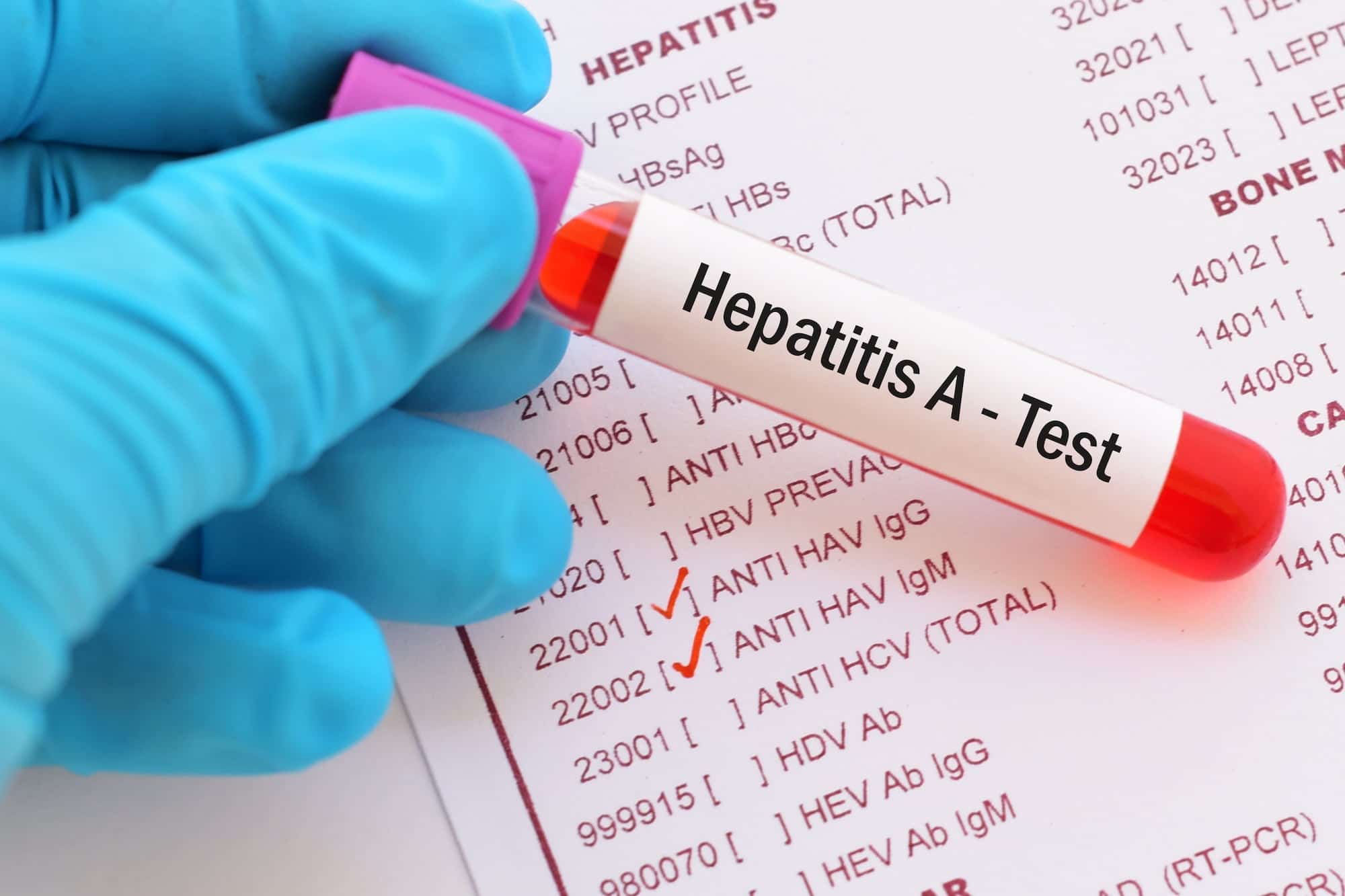 hepatitis a testing newcastle - STD & STI Testing Online - Stigma Health