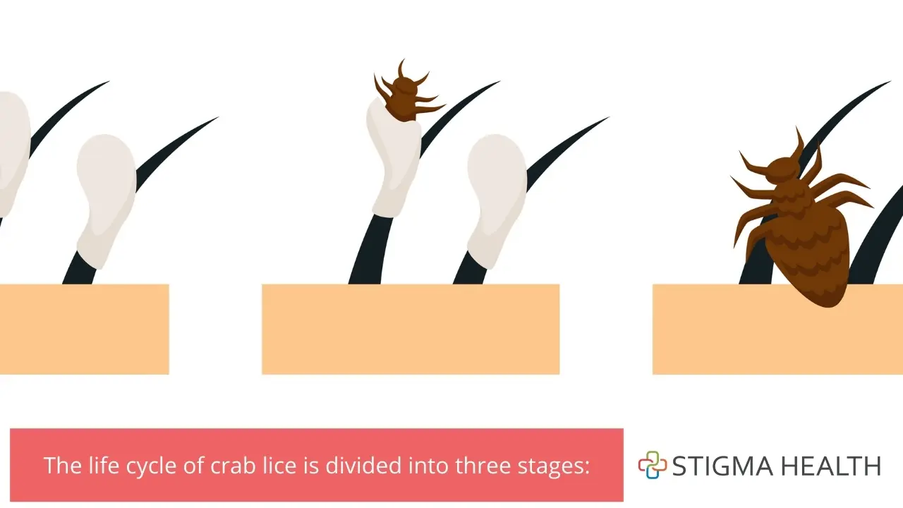 The life cycle of crab lice is divided into three stages