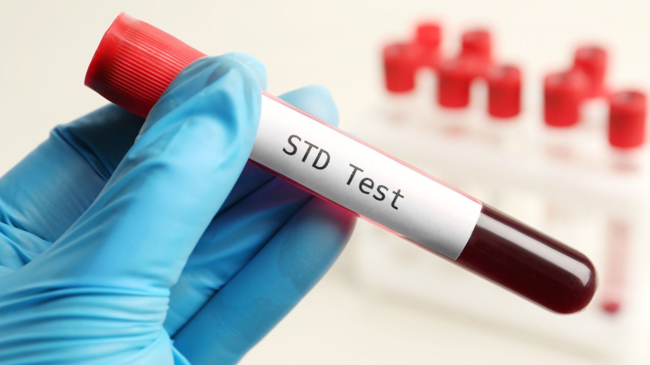 Person holding blood vile that says STD Test on it