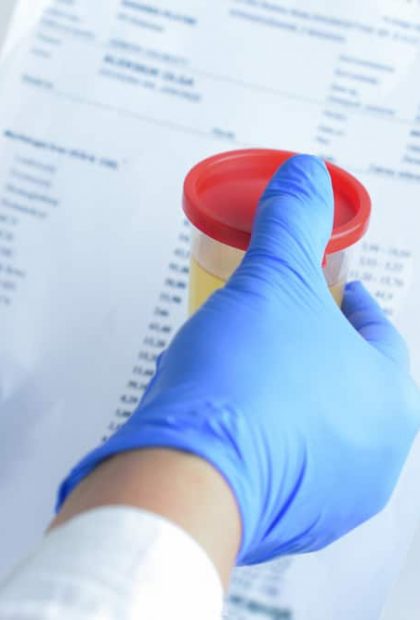 Pathology centre test - How STD Testing Works? - Stigma Health
